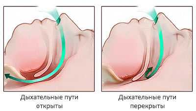 дыхательные пути